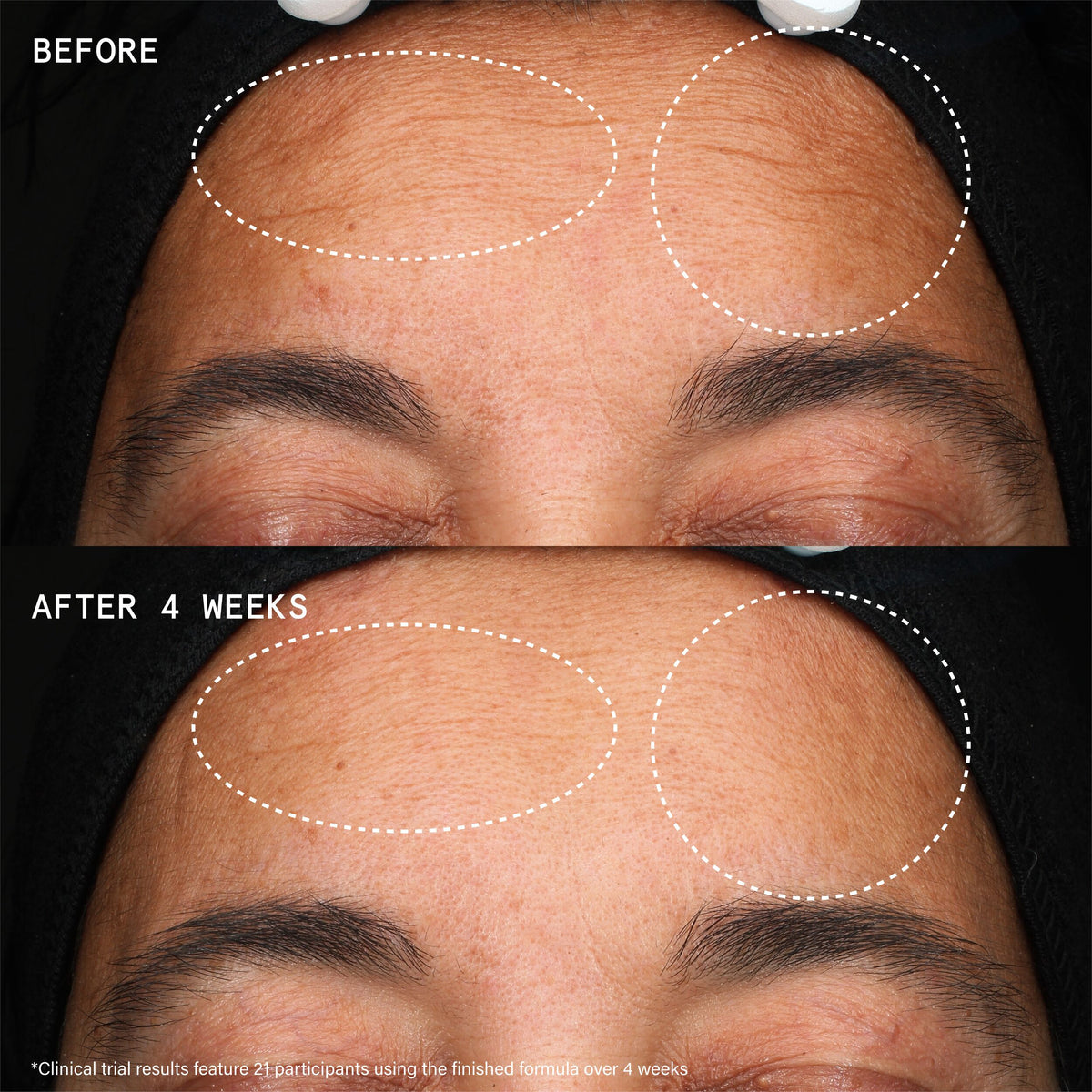 NEW_YOUTHBOMB_EXTREME_PDP_1X1_76502_ECOM_BEFORE_AFTER_2025_WEB